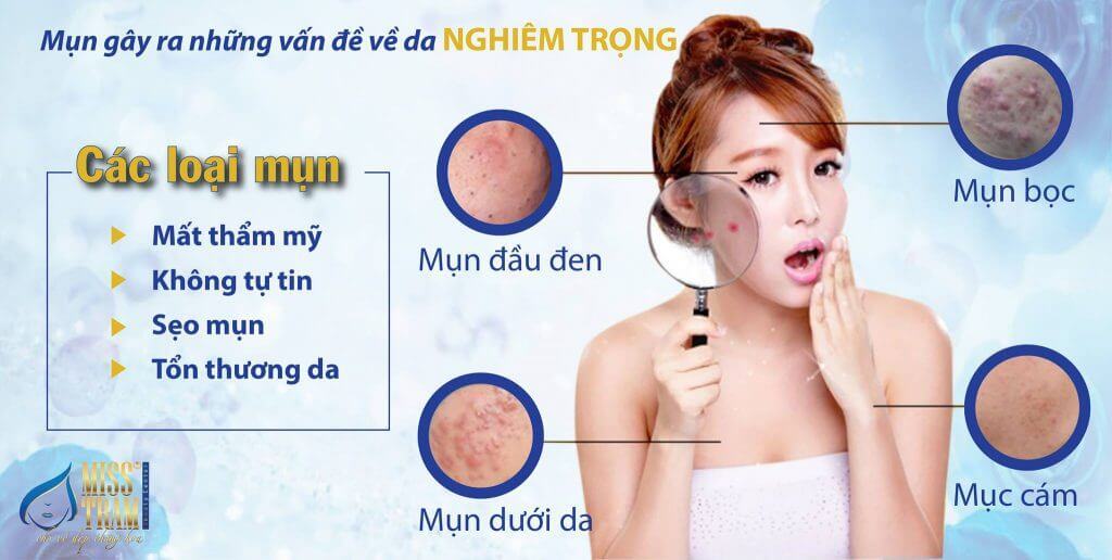 Điều Trị Mụn Bằng Công Nghệ Xung Kích Vi Điểm Đầy đủ