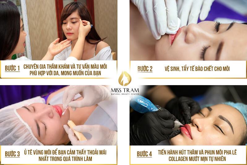 Hút Thâm Phun Môi Collagen Vi Chạm Cho Nữ Đầy đủ