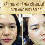 Kết quả đôi chân mày đẹp sau xử lý mày cũ, điêu khắc mày phẩy sợi 9D Nghiên cứu