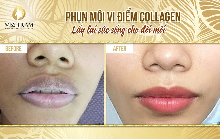 What to do when lips are dark?
