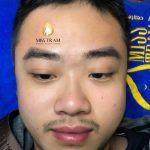 Kết Quả Điều Khắc Chân Mày Nam Cho Khách Hàng Mới Nhất Nghiên cứu