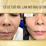 Làm Môi Cho Cô Lớn Tuổi Lên Màu Cực Chuẩn