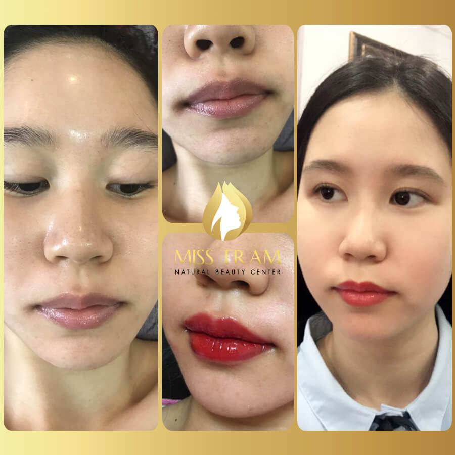 Beautiful lip spray results