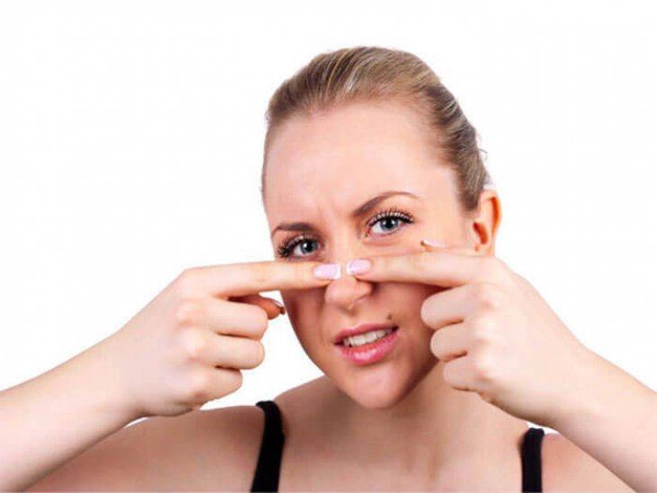 Cách chăm sóc da mặt bị sẹo rỗ