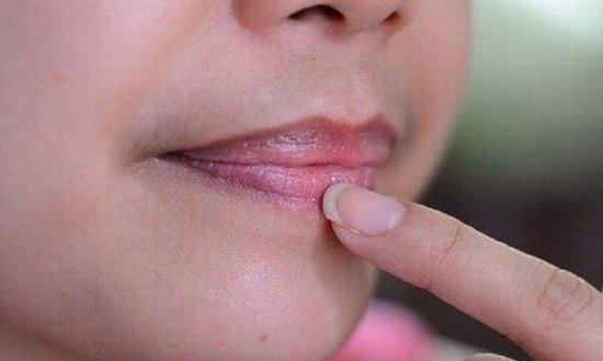 Why Spray Lips Back Full Dark