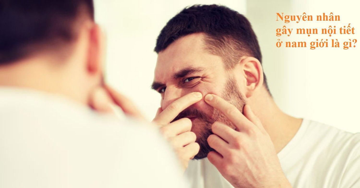 How to Treat Endocrine Acne for Men Safe Belief