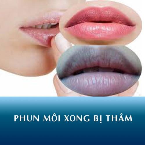 phun môi về bị thâm đen