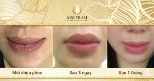 What to pay attention to when spraying lips?