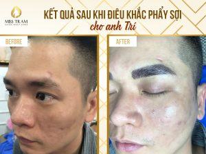 Kết quả điêu khắc mày phẩy sợi cho Anh Trí Tin tức