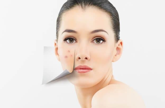 Causes And Treatment Of Pimples On The Cheeks Catch