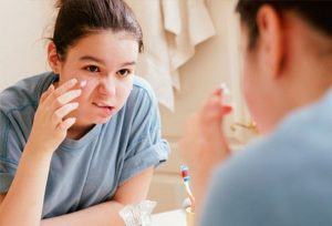 The Most Effective Hormonal Acne Treatment Method Popular
