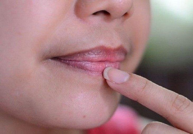Môi Không Thâm Có Cần Xử Lý Môi Khi Làm Không
