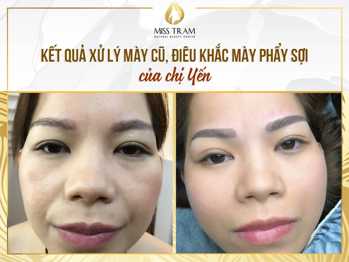 Old Eyebrow Treatment Results - Thread Sculpting For Ms. Yen Expert