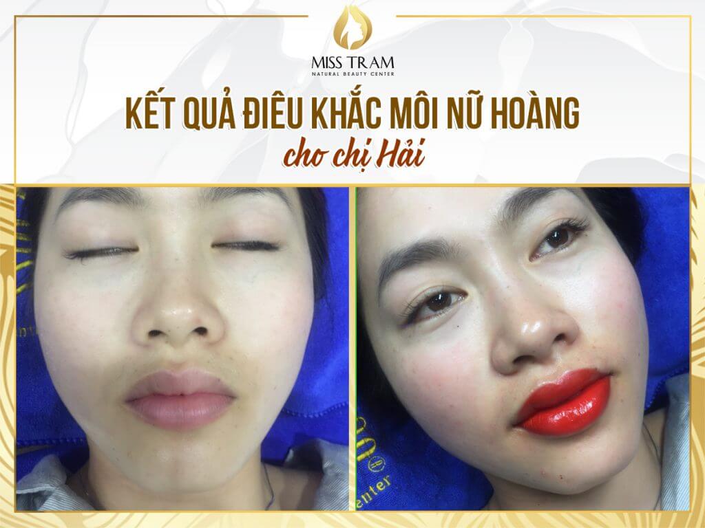 Sister Hai's Surprising Results After Sculpting Ink Lips Queen Perspective