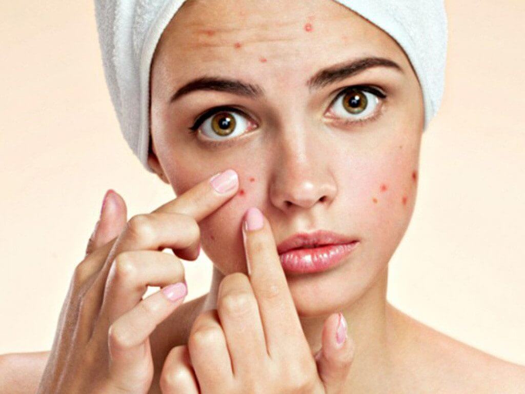 Diet for people with endocrine acne