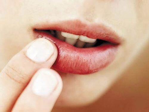 Instructions on How to Treat Lips After Spraying Are Dry Behind