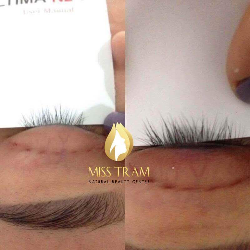 Promotion of Eyelash Growth Stimulation Package - Eyebrow From Sheep Placenta DNA List