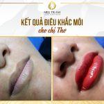 Actual Photo Results Sister Sculpting Lips At Research Spa