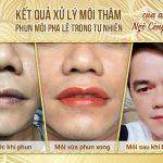 Ảnh Kết Quả Phun Môi Pha Lê Trong Tự Nhiên Cho Anh Công Vân Nghiên cứu