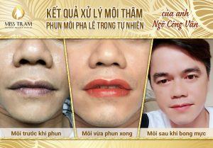 Photo Result of Spraying Crystal Lips In Nature For Anh Cong Van News