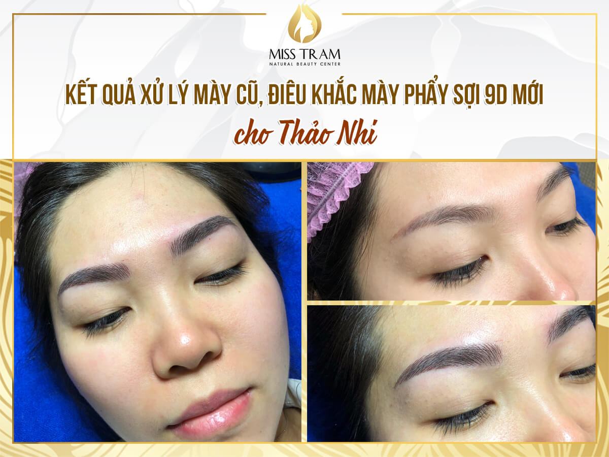 Treating old eyebrows - Sculpting new eyebrows with natural fibers for Thao Nhi Results