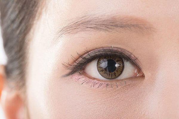 Mí mắt trỗ xanh và cách khắc phục hiệu quả nhất