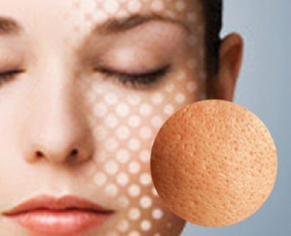 Use treatments to help shrink pores