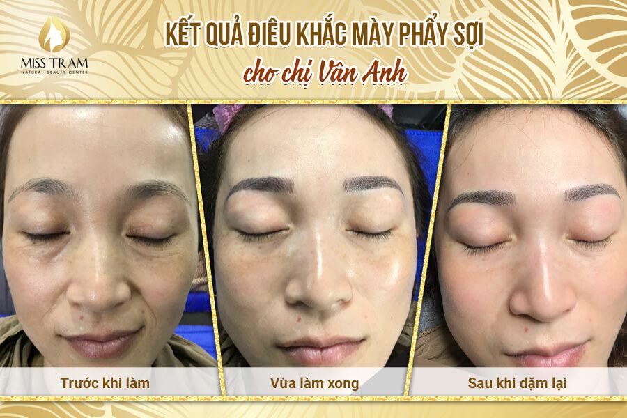 Results of eyebrow sculpting for Ms. Van Anh Latest Open eyes