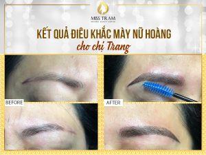 Kết Quả Điêu Khắc Mày Nữ Hoàng Đẹp Cho Chị Trang Phổ biến