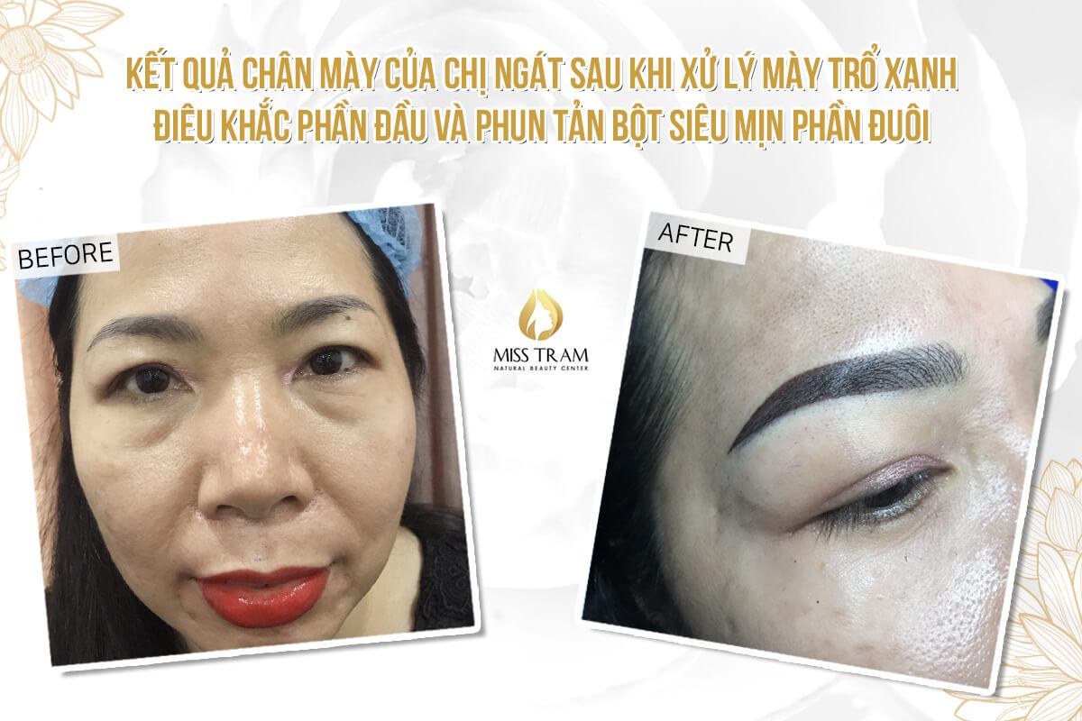 The Results of Treatment of Green Eyebrows, Head Sculpting & Spraying Powder for Her eyebrows