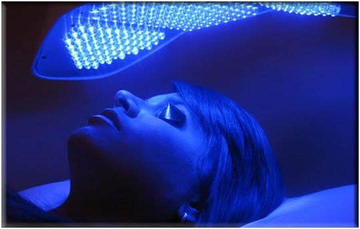 Use blue light to treat acne at the root