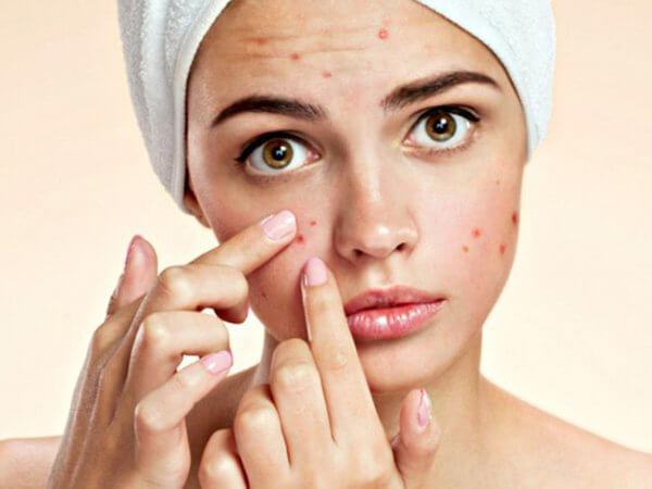 Is Green Laser technology effective for acne treatment - Effective acne treatment with Green Laser technology