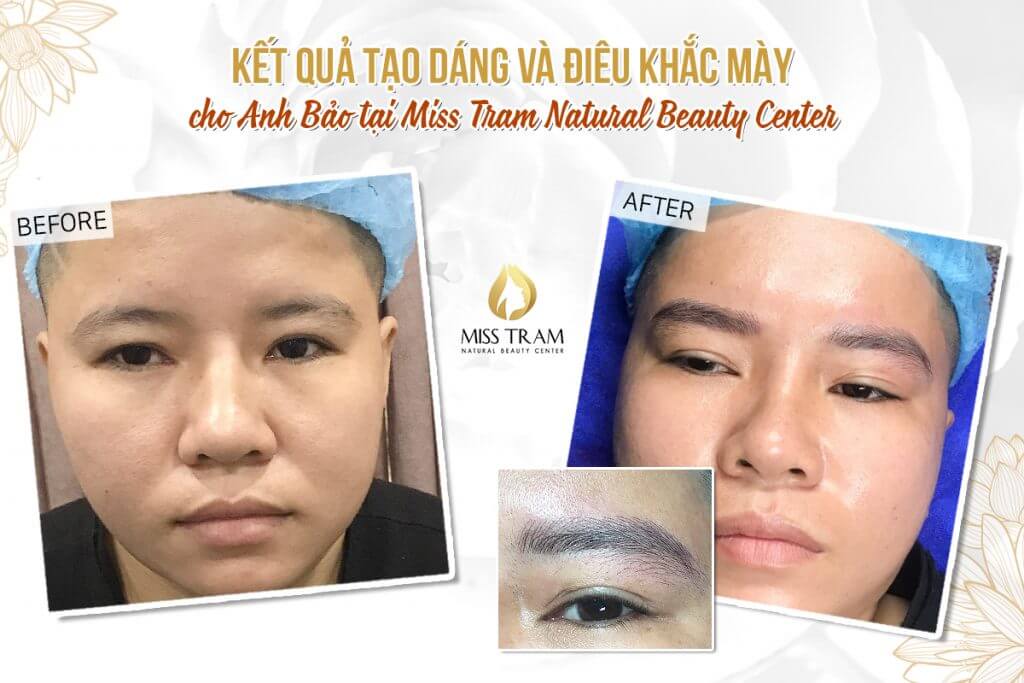 Results of Male Eyebrow Sculpture for Anh Bao Results