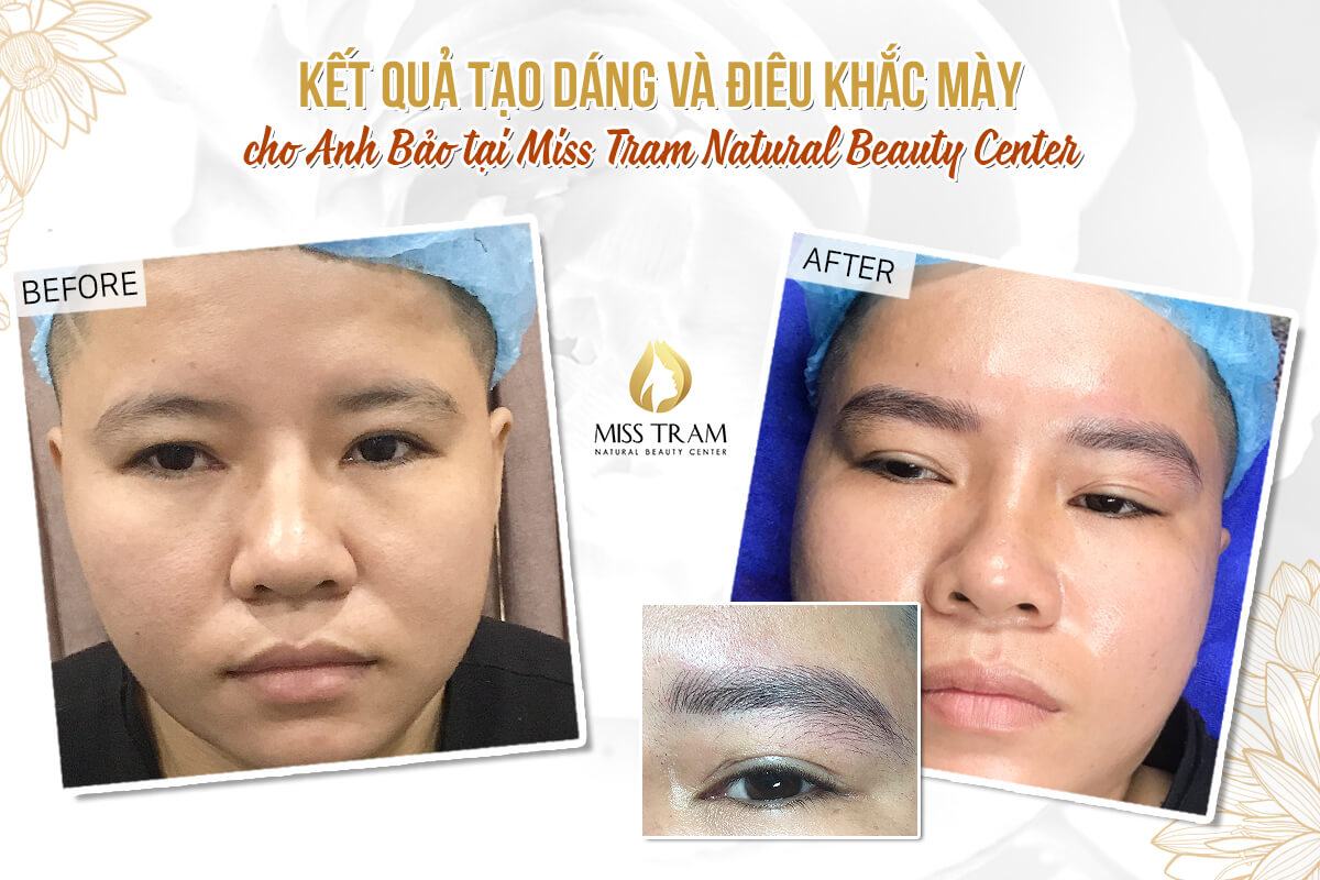Results of Male Eyebrow Sculpture for Anh Bao News