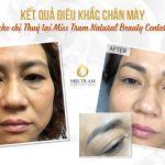 Kết Quả Điêu Khắc Chân Mày Đẹp Cho Chị Thuỷ Nghiên cứu