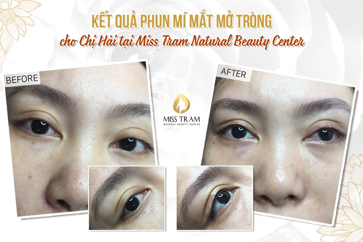 The Results of Natural Eyelid Spray For Ms. Hai Are Authentic