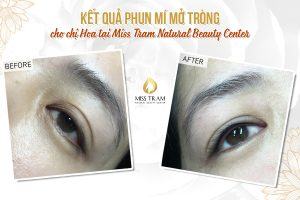 Flower Eyelid Spray Results For Ms. Hoa News