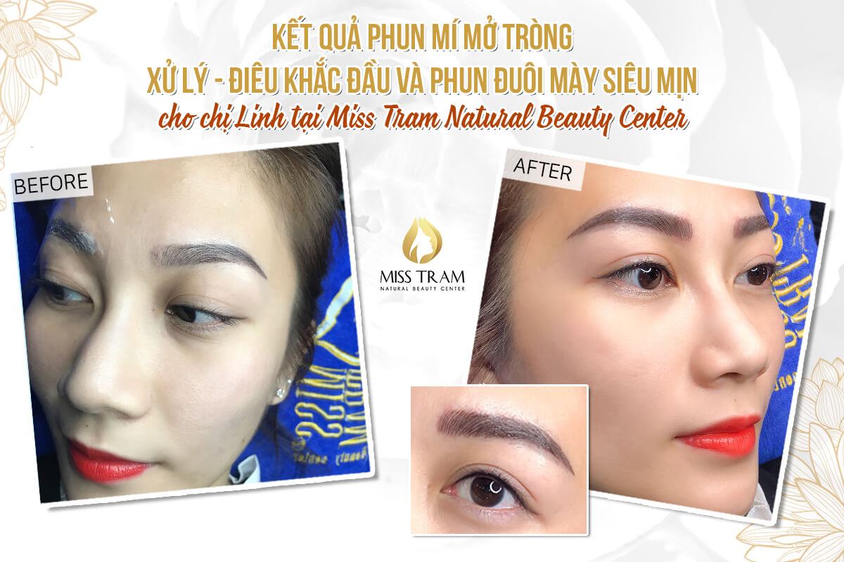 Result of Eyelid Spray - Sculpting Head And Spraying Eyebrows For Ms. Linh Specializes