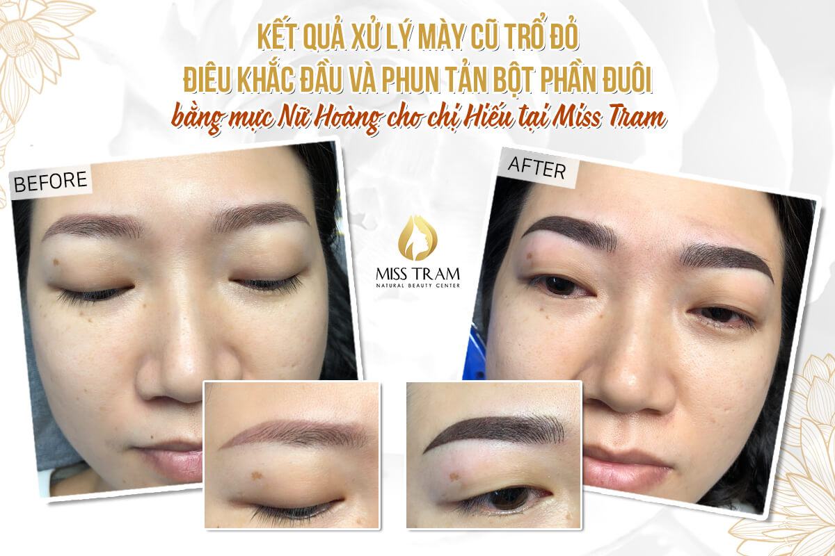 Hieu's Eyebrow Results After Red-Breaking Treatment - Head Sculpting & Dispersing Tail Powder Principle