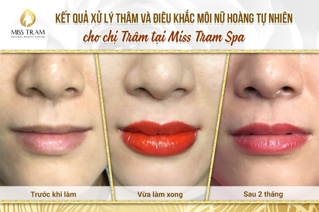 The results of processing and sculpting the Queen's lips for Ms. Tram are accurate