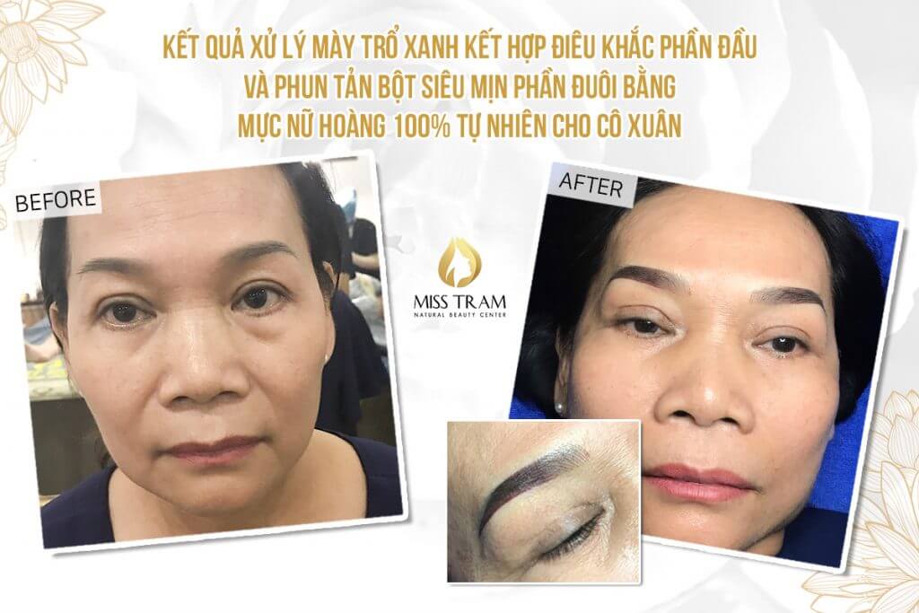 The Results of the Treatment of Green Eyebrows - Head Sculpting & Tail Powder Spraying For Limited Spring