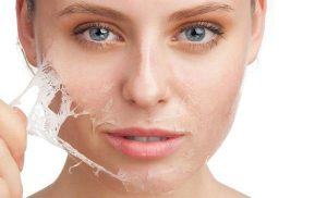 Skin Care Secrets After Burning Freckles Without Recurrence News