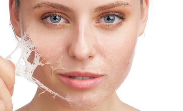 Skin Care Secrets After Burning Freckles Without Recurrence Notes