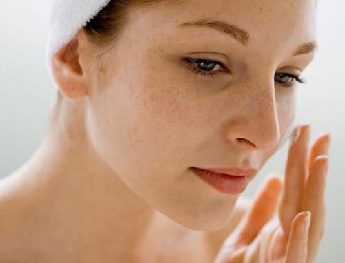 How to take care of your skin after burning freckles?