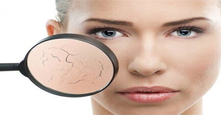Tại Sao Da Bị Khô Khi Dùng Kem Chống Nắng