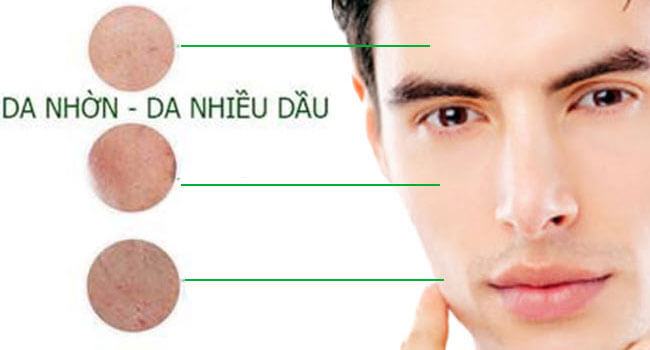 cách trị da mặt nhờn cho nam hiệu quả