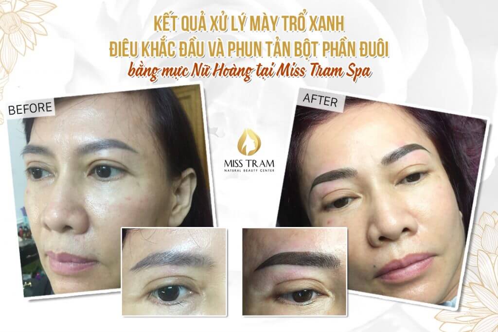 Kết Quả Xử Lý Xanh - Điêu Khắc Đầu Và Phun Tản Bột Phần Đuôi Chân Mày Cho Chị Vy Khám phá