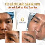 Kết Quả Điêu Khắc Chân Mày Của Anh Bình Nghiên cứu