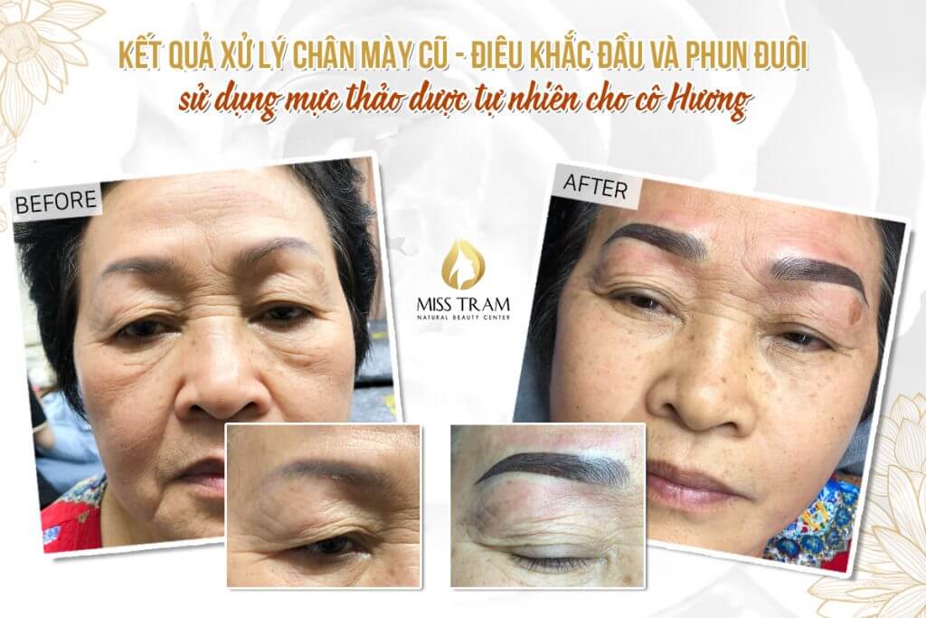 Old Eyebrow Treatment Results - Head Sculpting Combines Powder Spraying For Ms Huong Posts