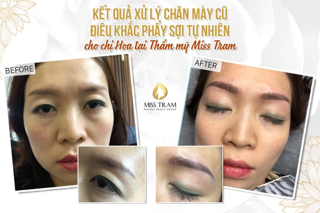 The Results of Eyebrow Treatment and Sculpting for Sister Hoa Acknowledged